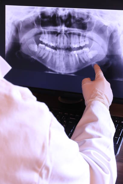Best Urgent Care for Lost Fillings or Crowns in Lake Of The Pines, CA