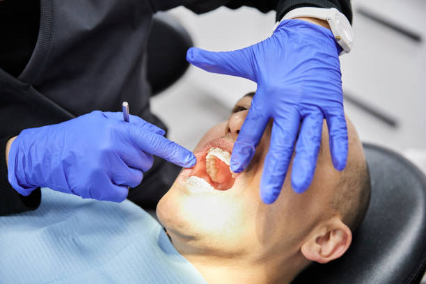 Best Emergency Treatment for Dental Infections or Abscesses in Lake Of The Pines, CA